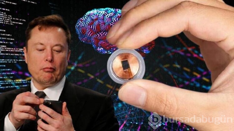Tartışmalı Neuralink projesinin perde arkasında neler yaşanıyor?