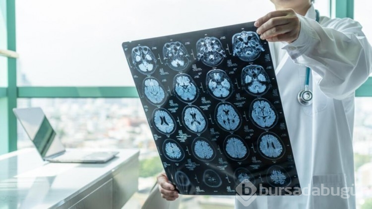 Alzheimer tedavisinde umut ışığı