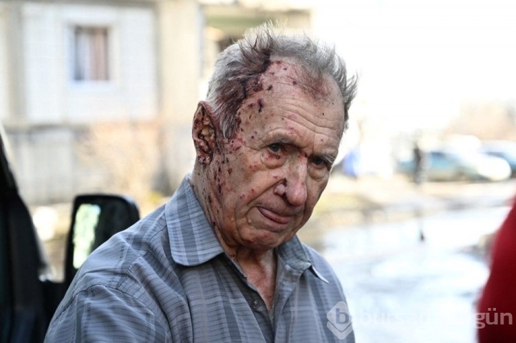 Ukrayna cehennemi yaşıyor! Savaştan kareler...