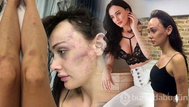 Sevgilisi Sırp model Tanja Dukiç'i dövdüğü iddia edilen yönetmen Çağrı Reşat Mehmet Tortop'un yaralama davasında karar
