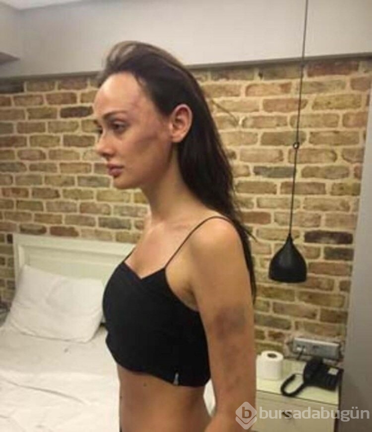 Sevgilisi Sırp model Tanja Dukiç'i dövdüğü iddia edilen yönetmen Çağrı Reşat Mehmet Tortop'un yaralama davasında karar
