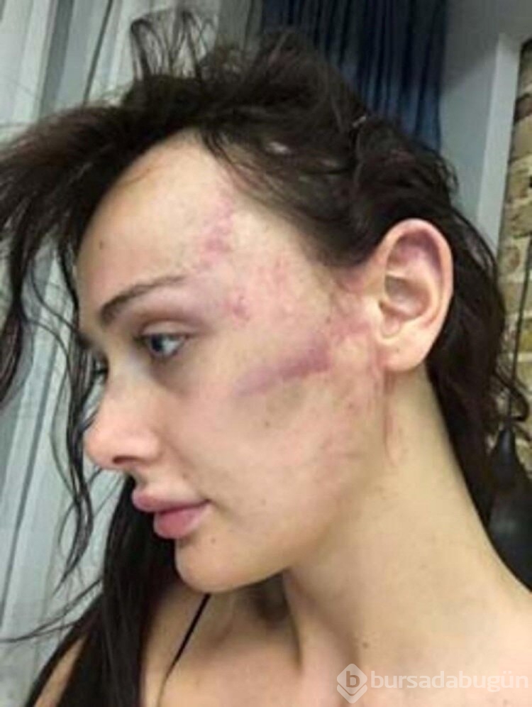 Sevgilisi Sırp model Tanja Dukiç'i dövdüğü iddia edilen yönetmen Çağrı Reşat Mehmet Tortop'un yaralama davasında karar
