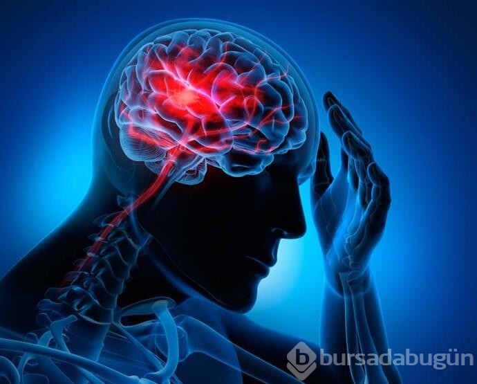 Beyin kanamasını tetikleyen riskler