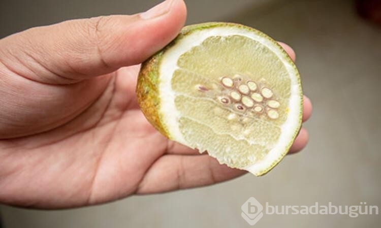 Böbrek yetmezliğinden koruyan besinler...