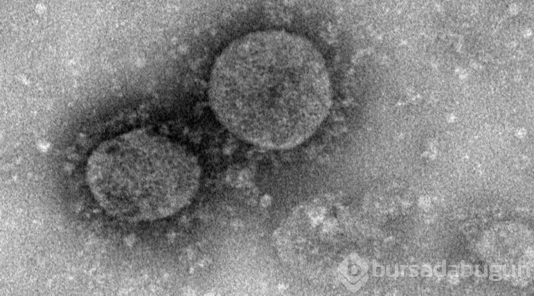 Gizemli hepatit vakalarına uyarı!