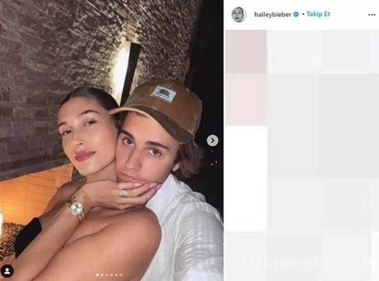 Hailey Bieber'in ortaya çıkan felç hastalığı...