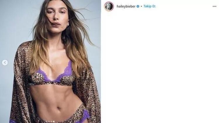 Hailey Bieber'in ortaya çıkan felç hastalığı...