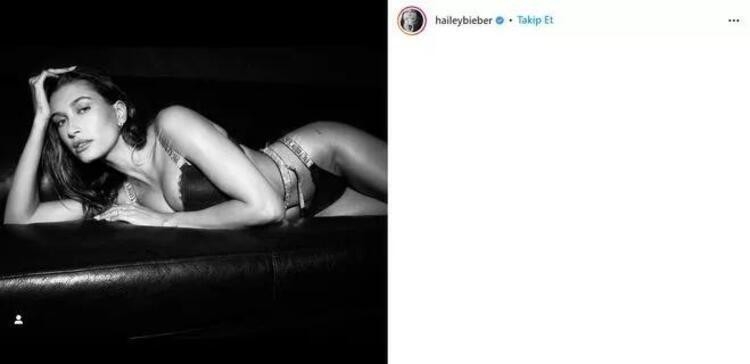Hailey Bieber'in ortaya çıkan felç hastalığı...