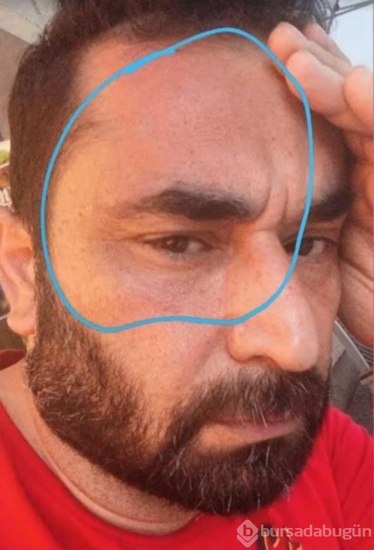 Ünlü oyuncu saldırıya uğradı!
