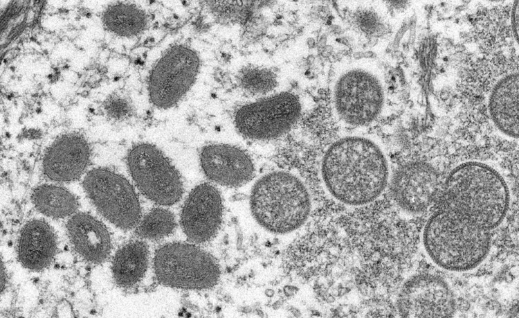 İngiliz bilim insanlarından uyarı: Maymun çiçeği salgını 10 kat büyüyebilir