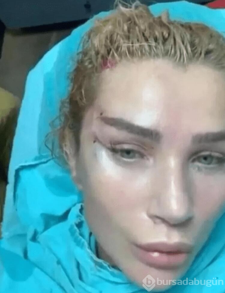 Seda Sayan tatil dönüşü direk estetik yaptırdı