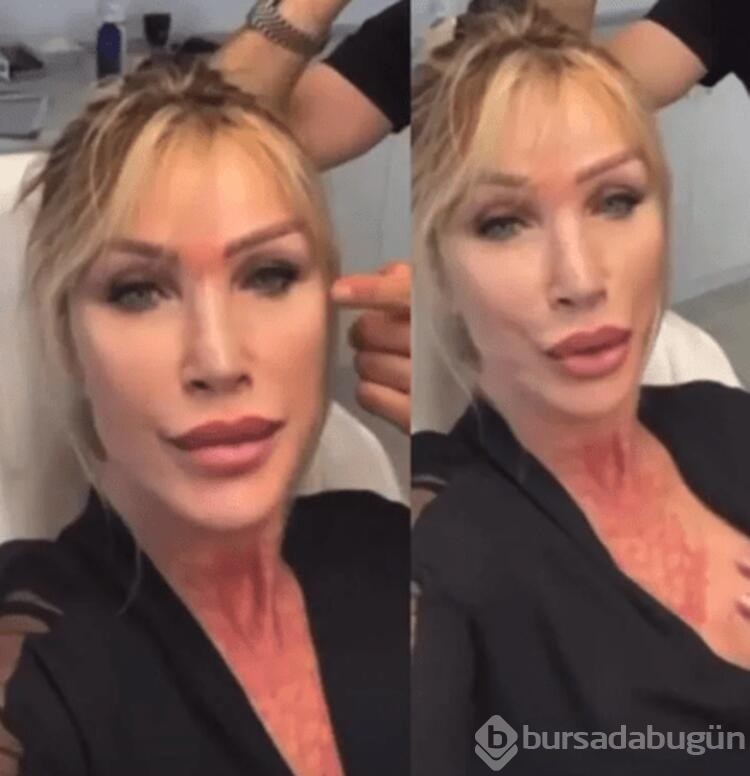 Seda Sayan tatil dönüşü direk estetik yaptırdı