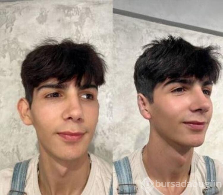 Taha Duymaz kulaklarına estetik yaptırdı