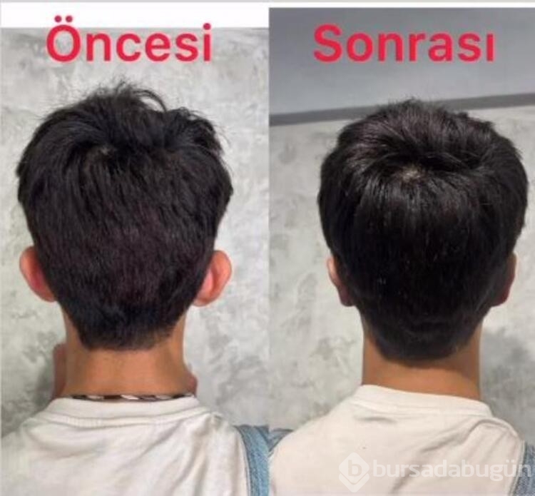 Taha Duymaz kulaklarına estetik yaptırdı