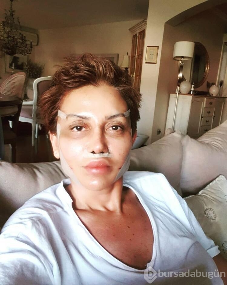 Estetik ile gündeme gelmişti! İşte Serap Paköz'ün son hali