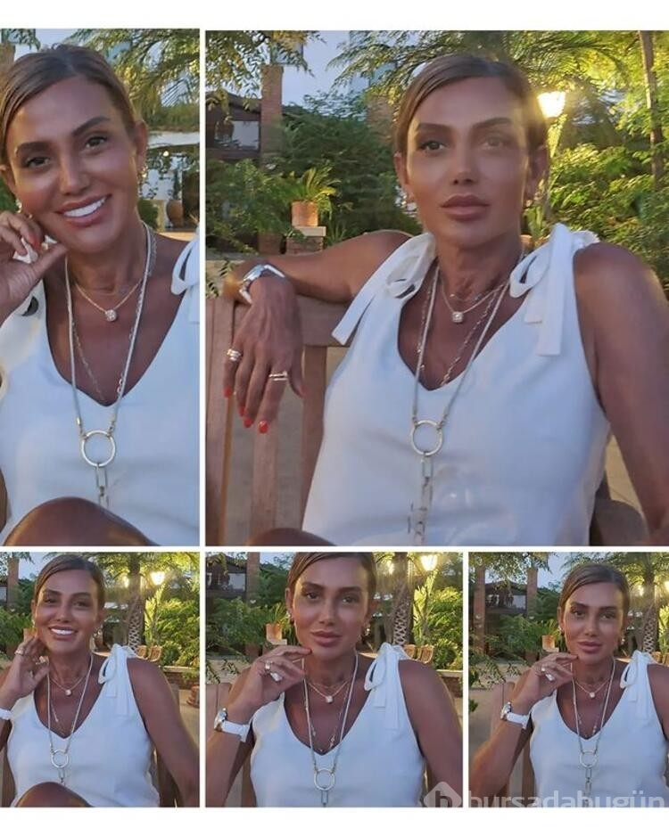 Estetik ile gündeme gelmişti! İşte Serap Paköz'ün son hali