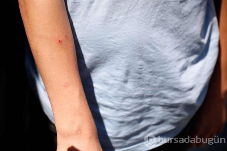 İstanbul'da 'Aedes' tehdidi