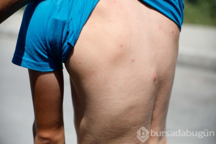 İstanbul'da 'Aedes' tehdidi