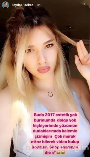 Survivor İlayda'nın estetiksiz hali çok konuşuldu!
