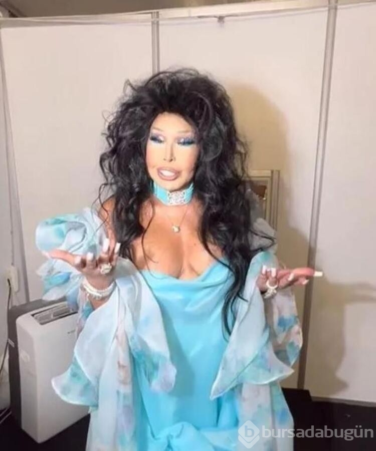 Bülent Ersoy, konserde verdiği frikikten sonra çift dikiş attırıyor!
