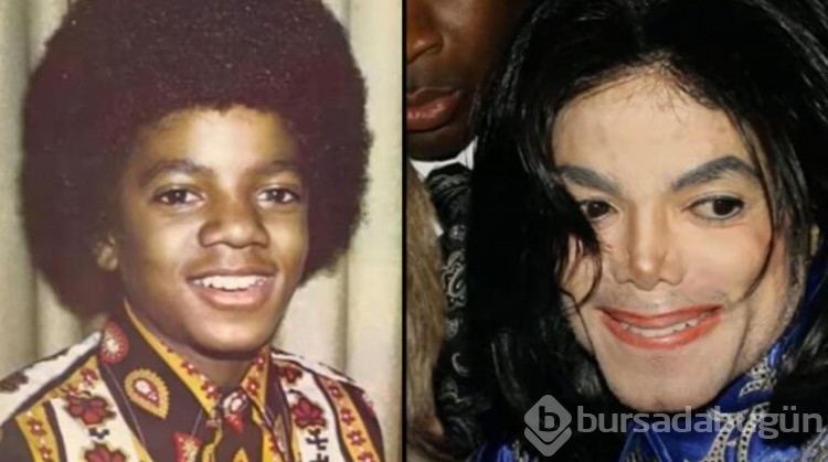 Micheal Jackson'ın 50 yıllık 'estetik' sırrı