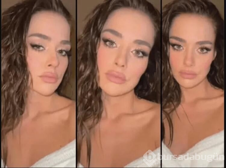 Bensu Soral estetik furyasına katıldı!