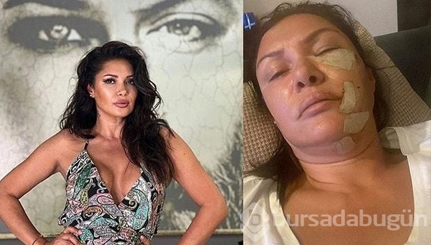 Tuğba Altıntop yaşadığı dehşeti anlattı: Yüzümde 50-60 dikiş var
