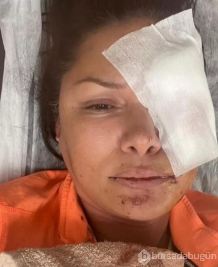 Tuğba Altıntop yaşadığı dehşeti anlattı: Yüzümde 50-60 dikiş var
