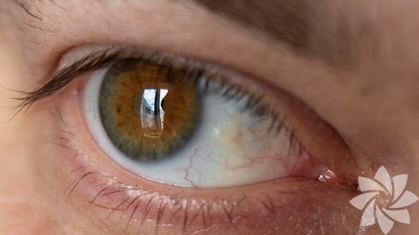Gözden teşhis edilebilen hastalıklar nelerdir?
