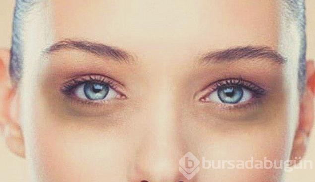 Göz altı morlukları için doğal maskesi önerisi
