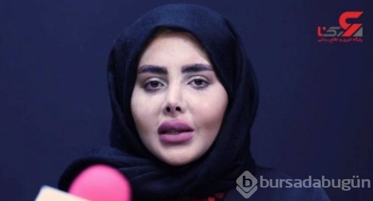 Zombi Angelina adıyla tanınan Sahar Tabar hiç estetik ameliyatı yaptırmadığını söyledi