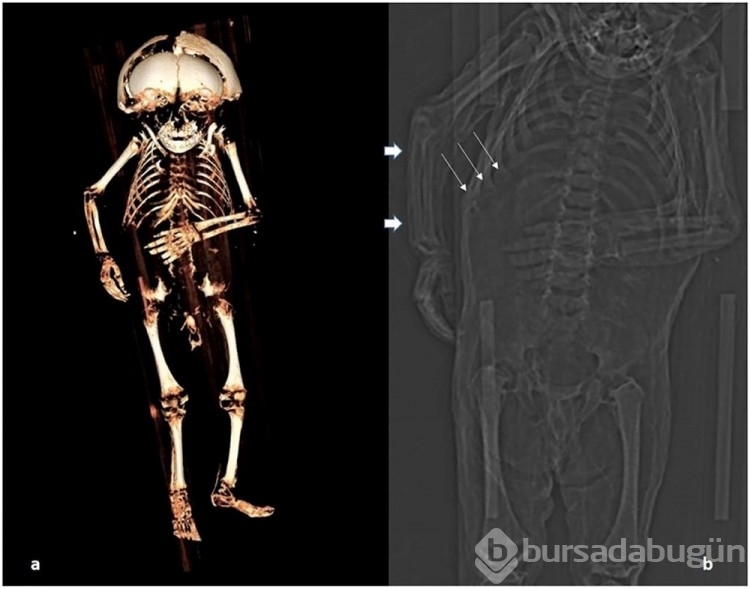 400 yıl önce ölen mumyalanmış bebeğin gizemi çözüldü!