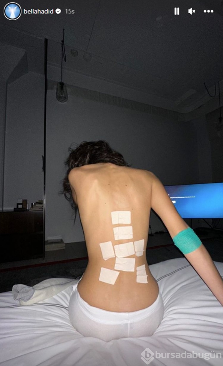 Bella Hadid hastane paylaşımıyla endişelendirdi
