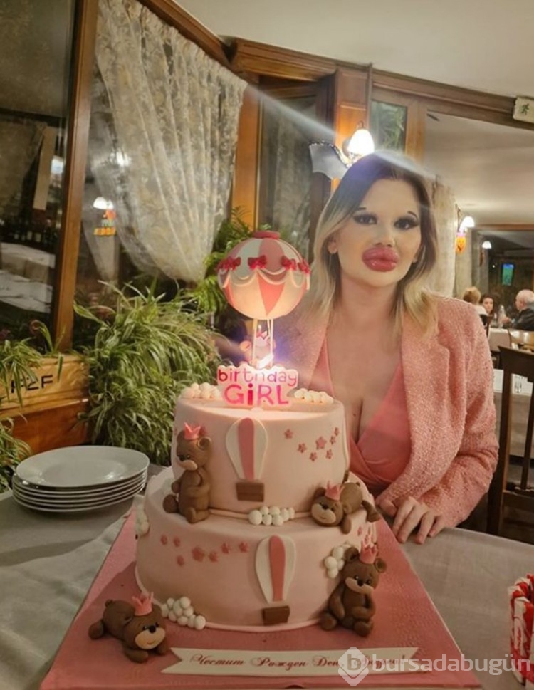 Dünyanın en büyük dudaklı kadını Andrea Ivanova
