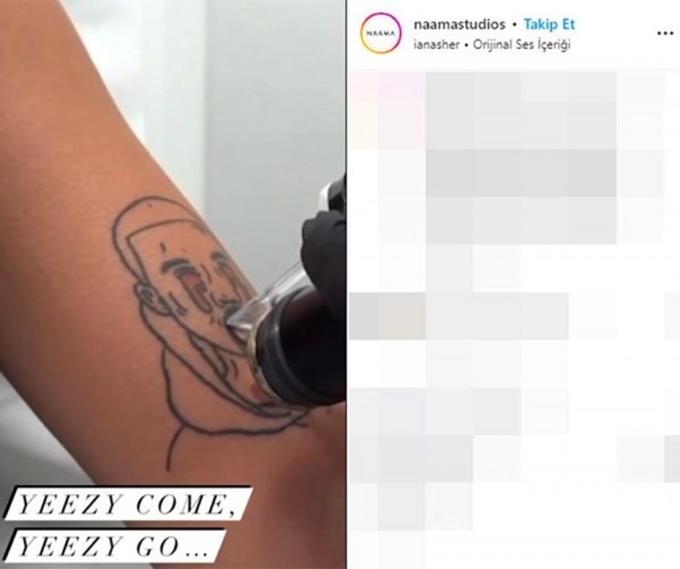 Kanye West dövmesinden pişman olanlara yardım