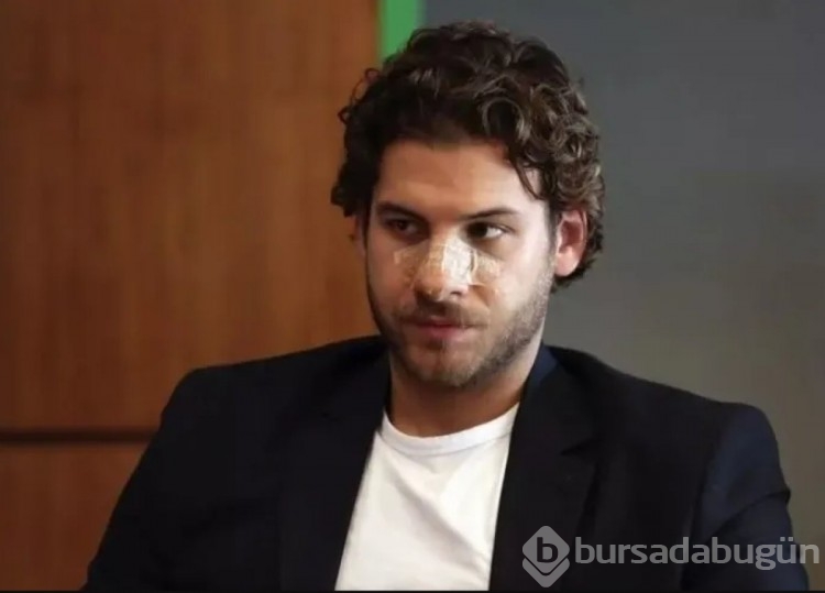 Mustafa Mert Koç burnuyla ilgili gerçeği açıkladı
