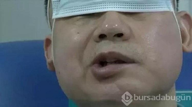 Dünya Kupası için 2 saat uyudu: Felç geçirdi