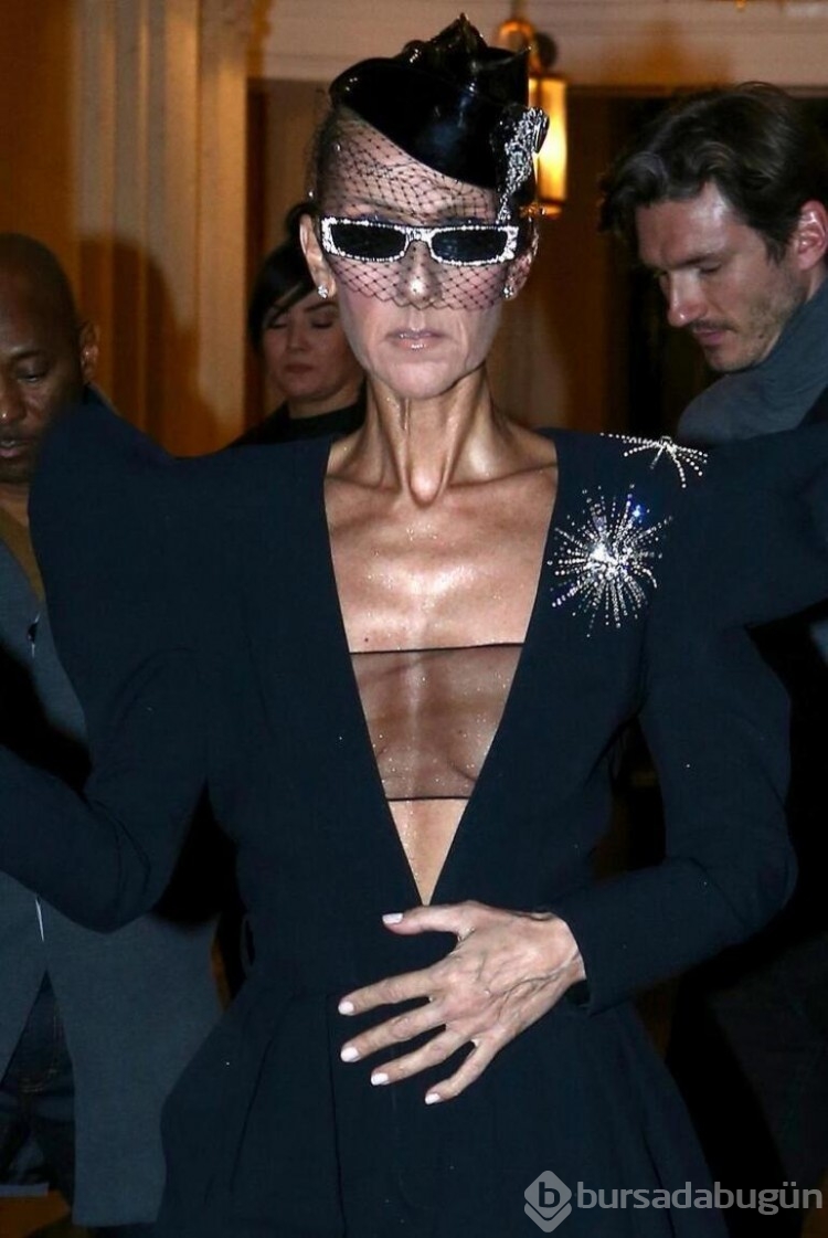 Celine Dion katı kişi sendromuna yakalandığını açıkladı