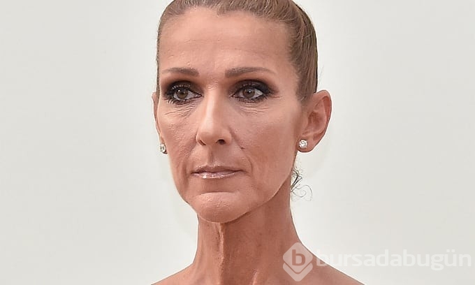 Celine Dion katı kişi sendromuna yakalandığını açıkladı