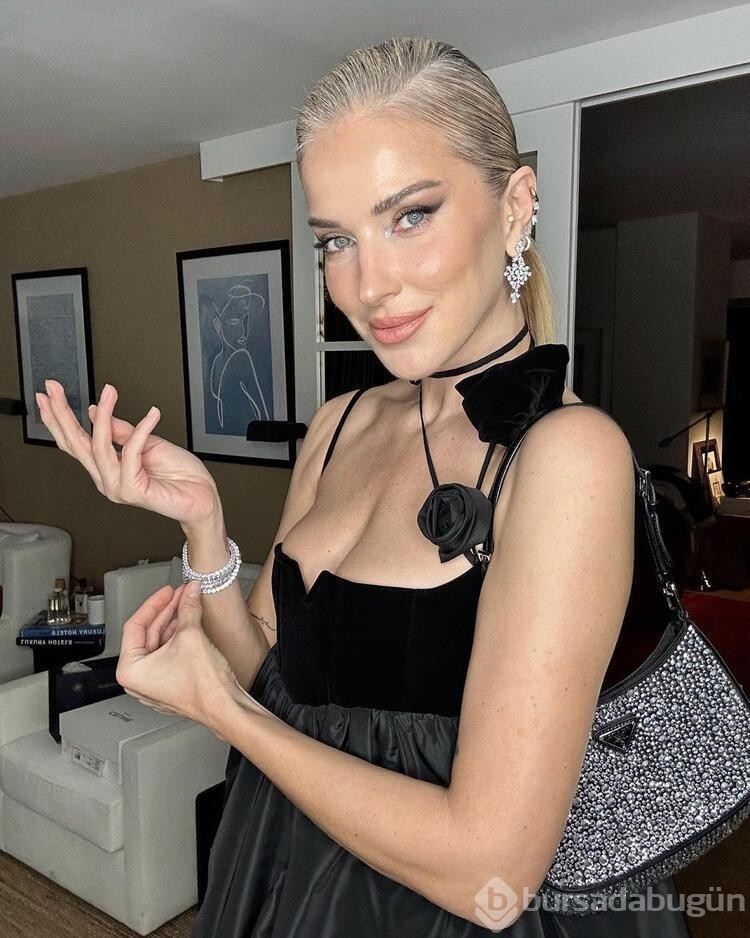 Burcu Esmersoy: Botoks ve dolgum yok