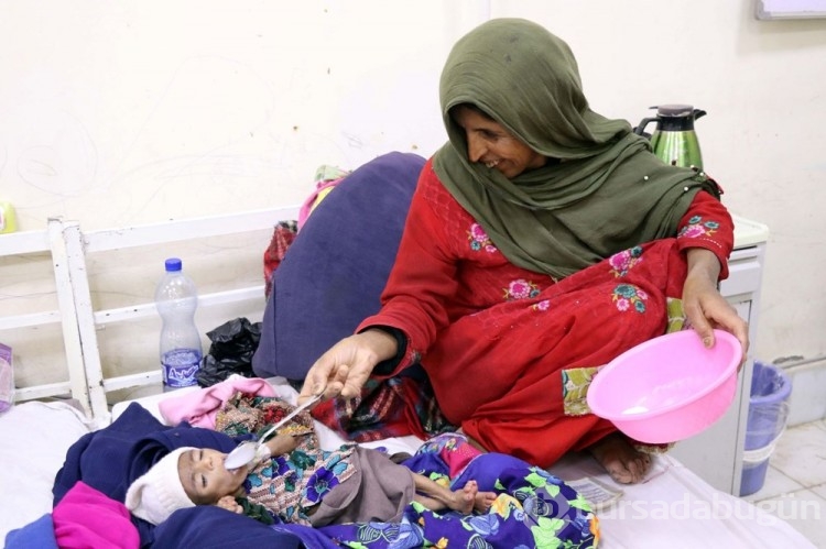 Afgan annelerin bebekleri büyüyemiyor