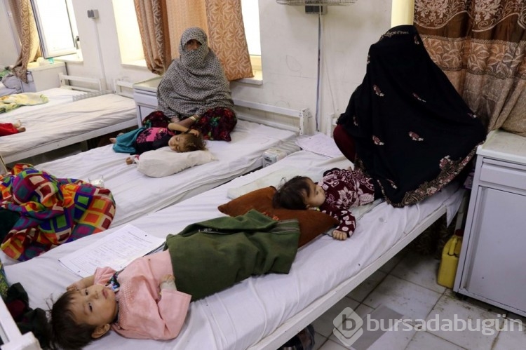 Afgan annelerin bebekleri büyüyemiyor