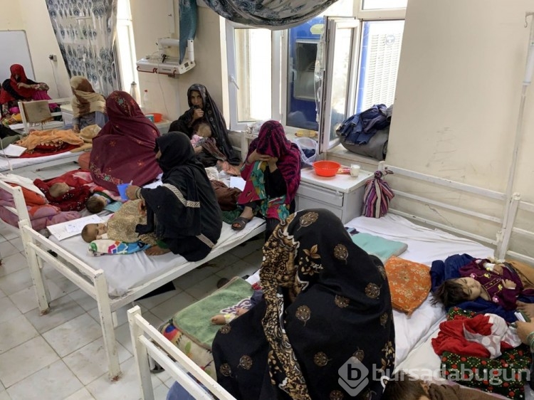 Afgan annelerin bebekleri büyüyemiyor