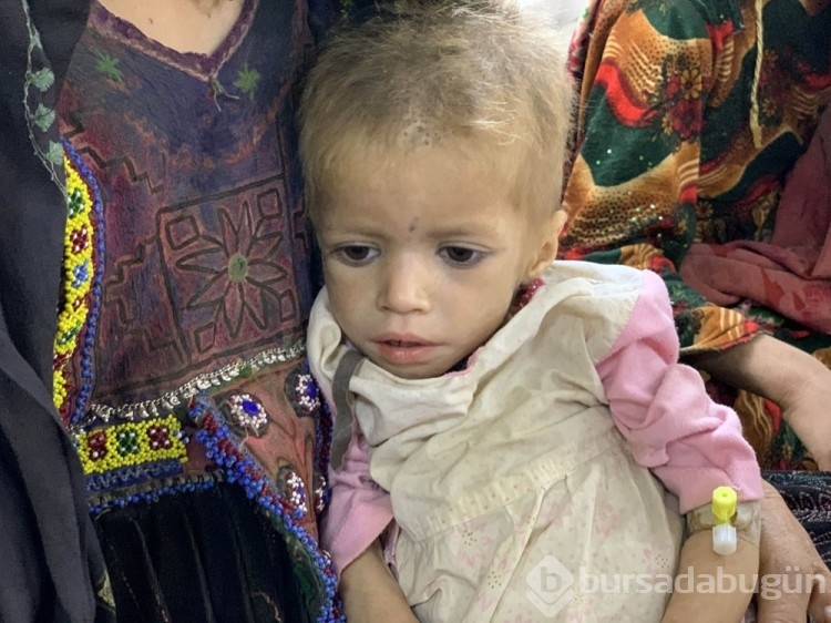 Afgan annelerin bebekleri büyüyemiyor