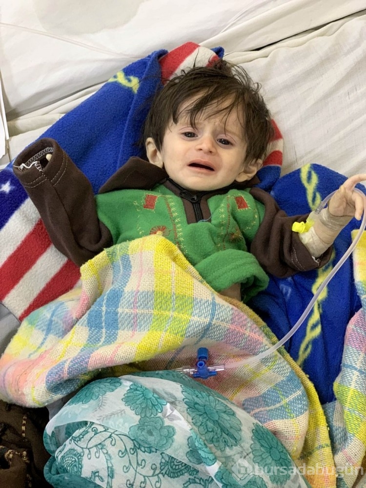 Afgan annelerin bebekleri büyüyemiyor