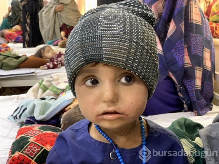 Afgan annelerin bebekleri büyüyemiyor