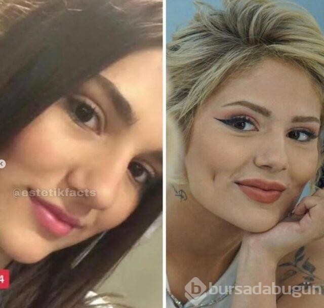 Aybüke'nin estetiksiz hali Hande Erçel'e benzetildi