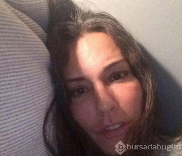 Ünlü manken Merve İldeniz son haliyle şaşırttı