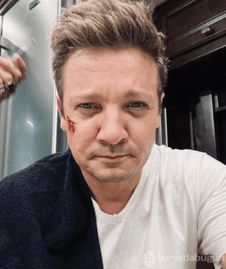  Kar kürerken kaza geçiren Jeremy Renner'ın son durumu nasıl?
