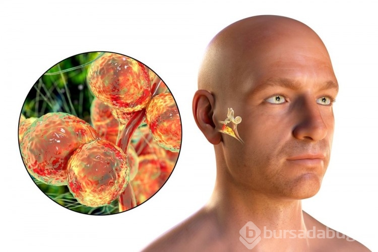 Yeni ölümcül salgın: Candida auris
